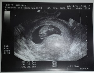 01.17.14 Ultrasound