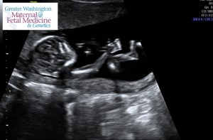 1.2.276.0.26.1.1.1.2.2014.81.58234.162763.46031872.57bfc6a6fc6.0000000000